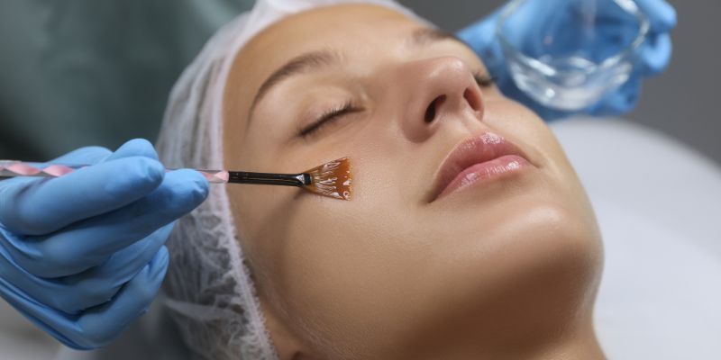 Patient getting chemical peel at Elysian Medspa & Rejuvenation Center