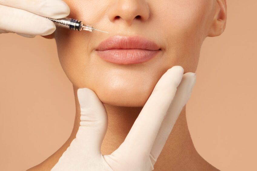 Patient receiving dermal fillers at Elysian Medspa & Rejuvenation Center