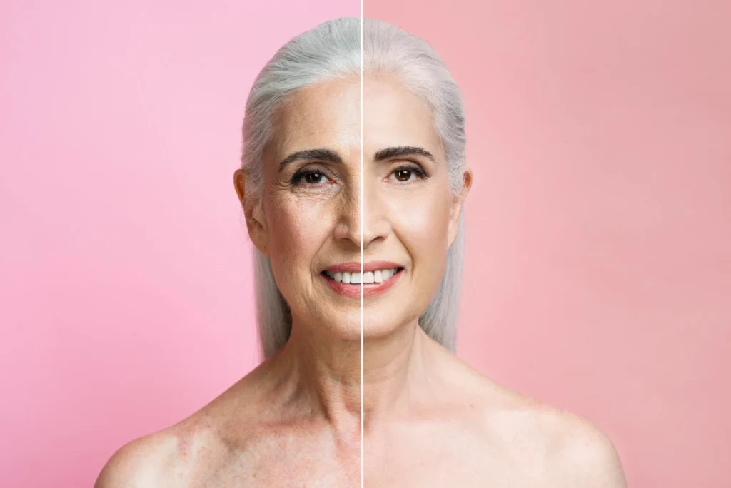 Elderly patient before & after at Elysian Medspa & Rejuvenation Center