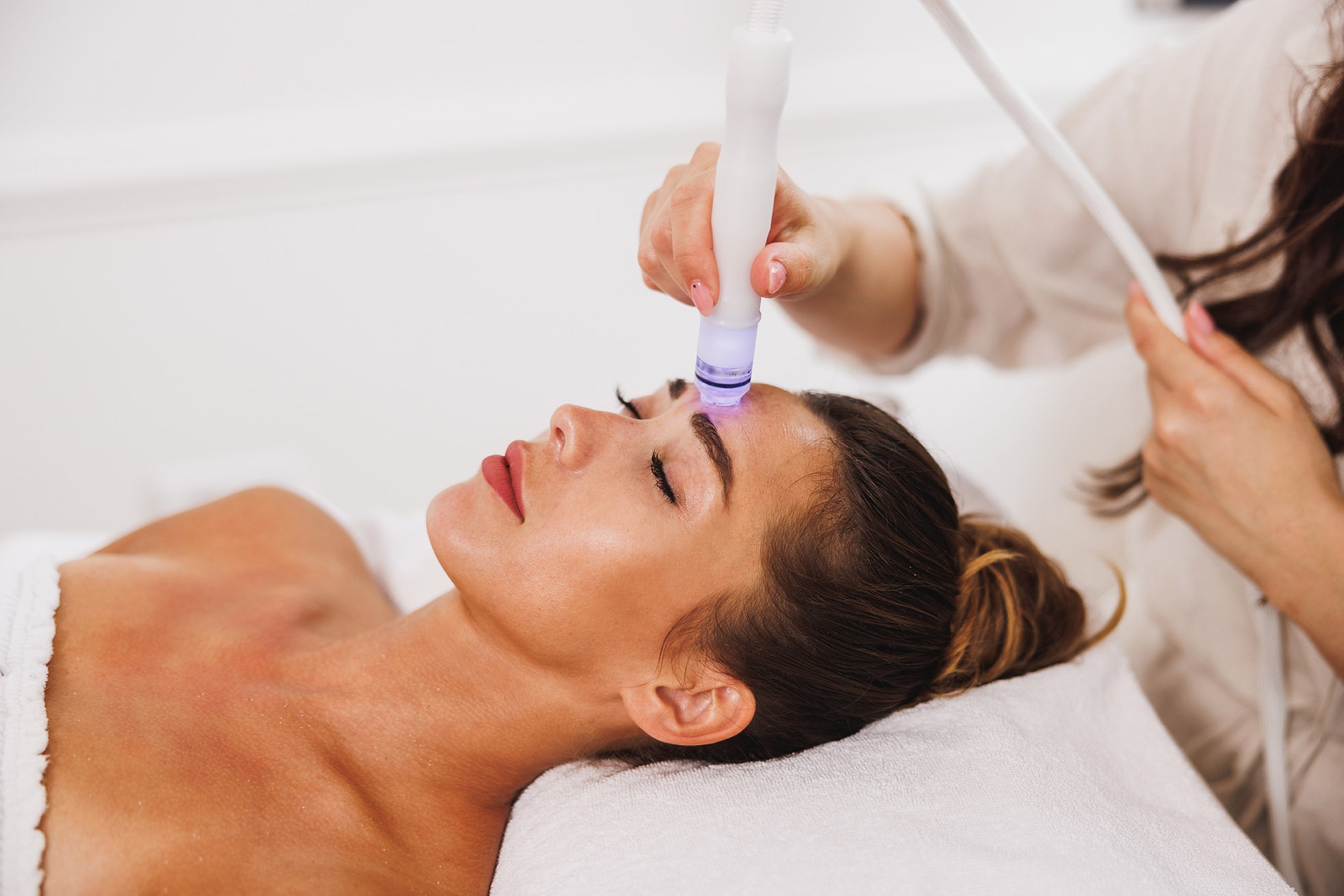 Patient getting microneedling treatment at Elysian Medspa & Rejuvenation Center