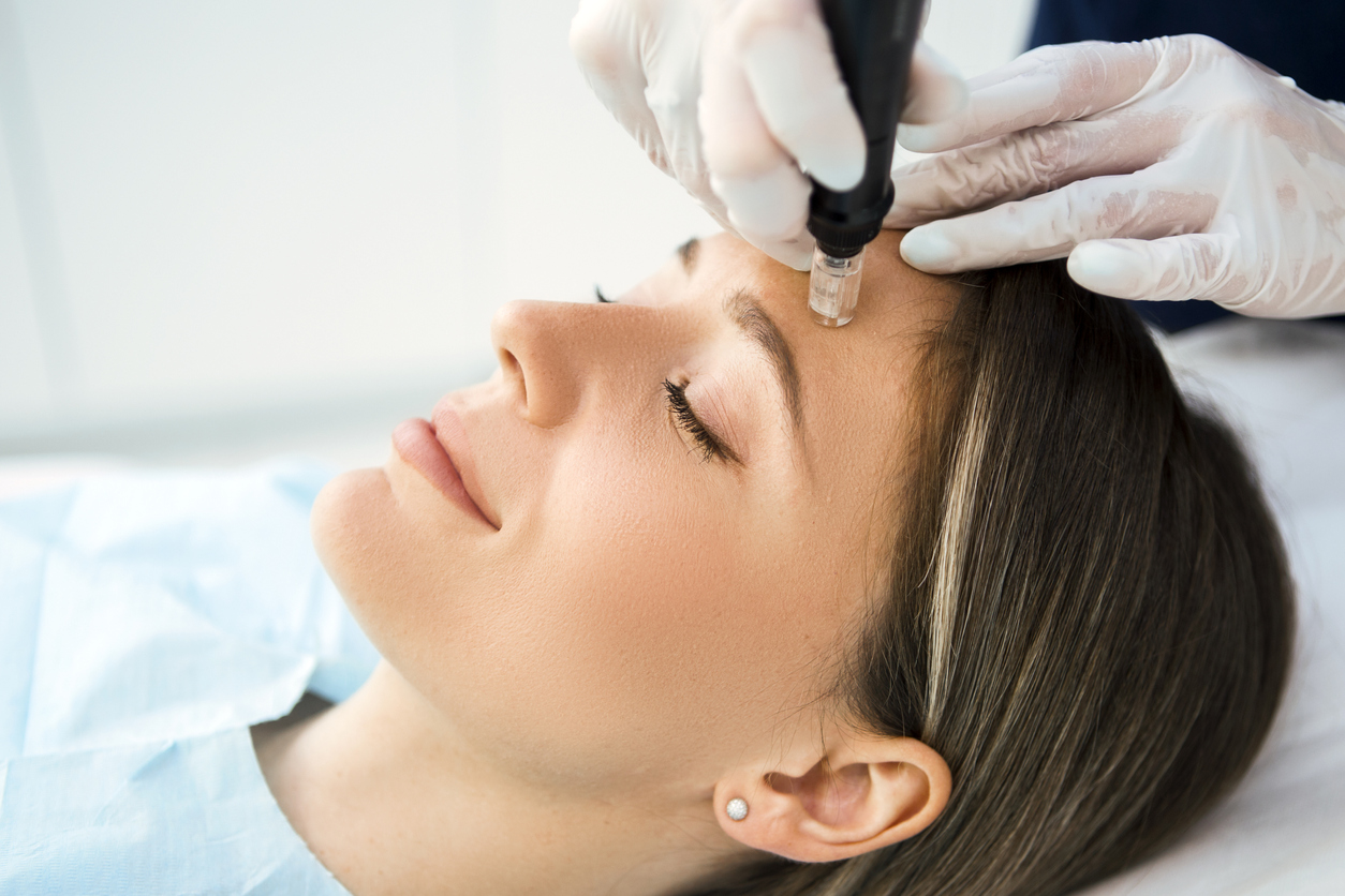 Patient getting PRP facial (vampire facial) at Elysian Medspa & Rejuvenation Center