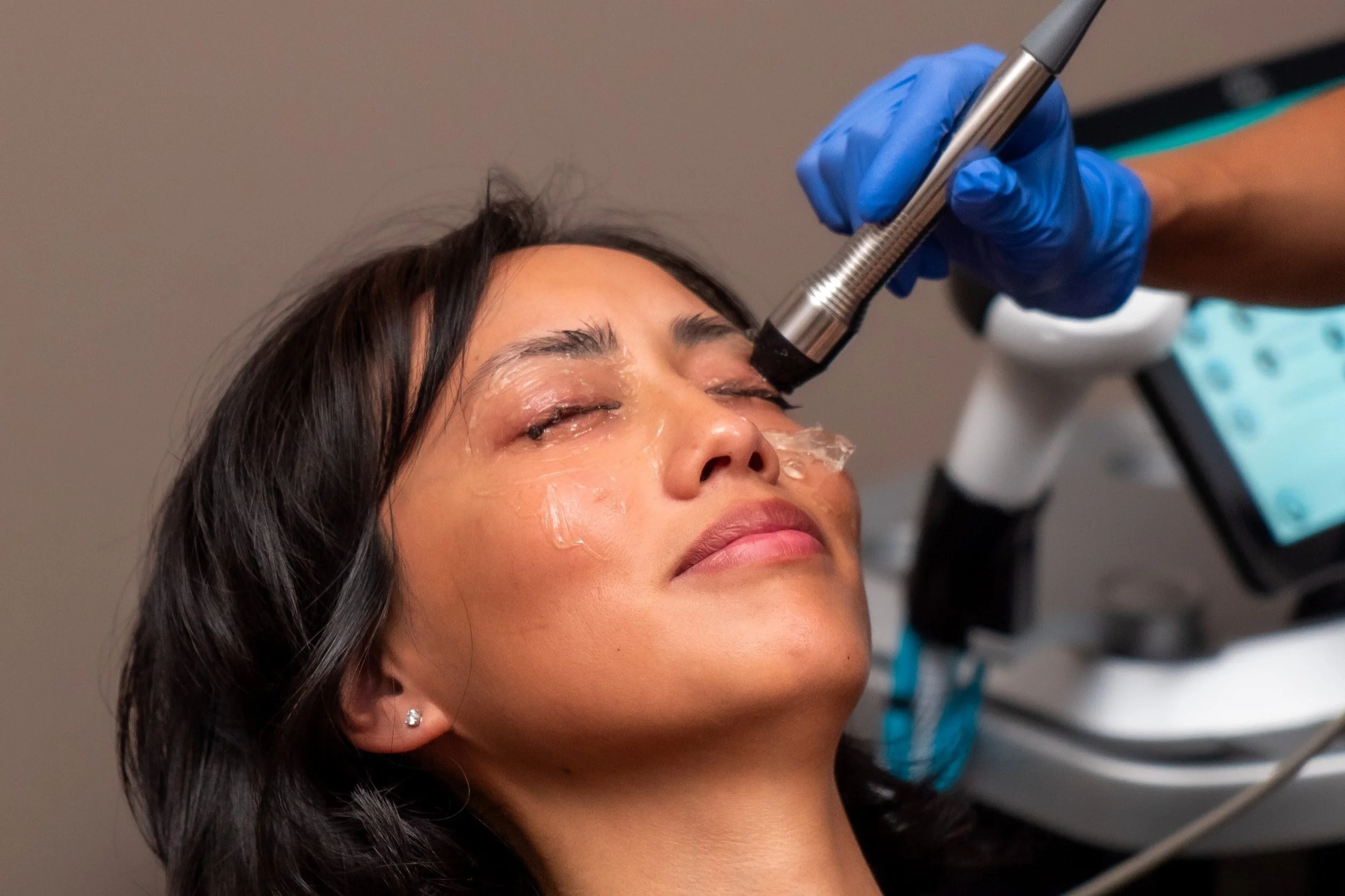 Patient getting inmode dry eye therapy at elysian medspa & rejuvenation center