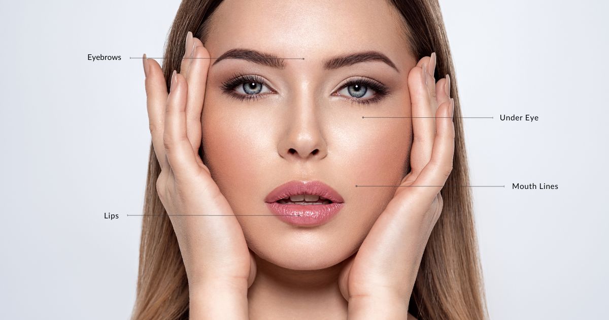 Model showing what areas can be treated with Juvederm dermal fillers