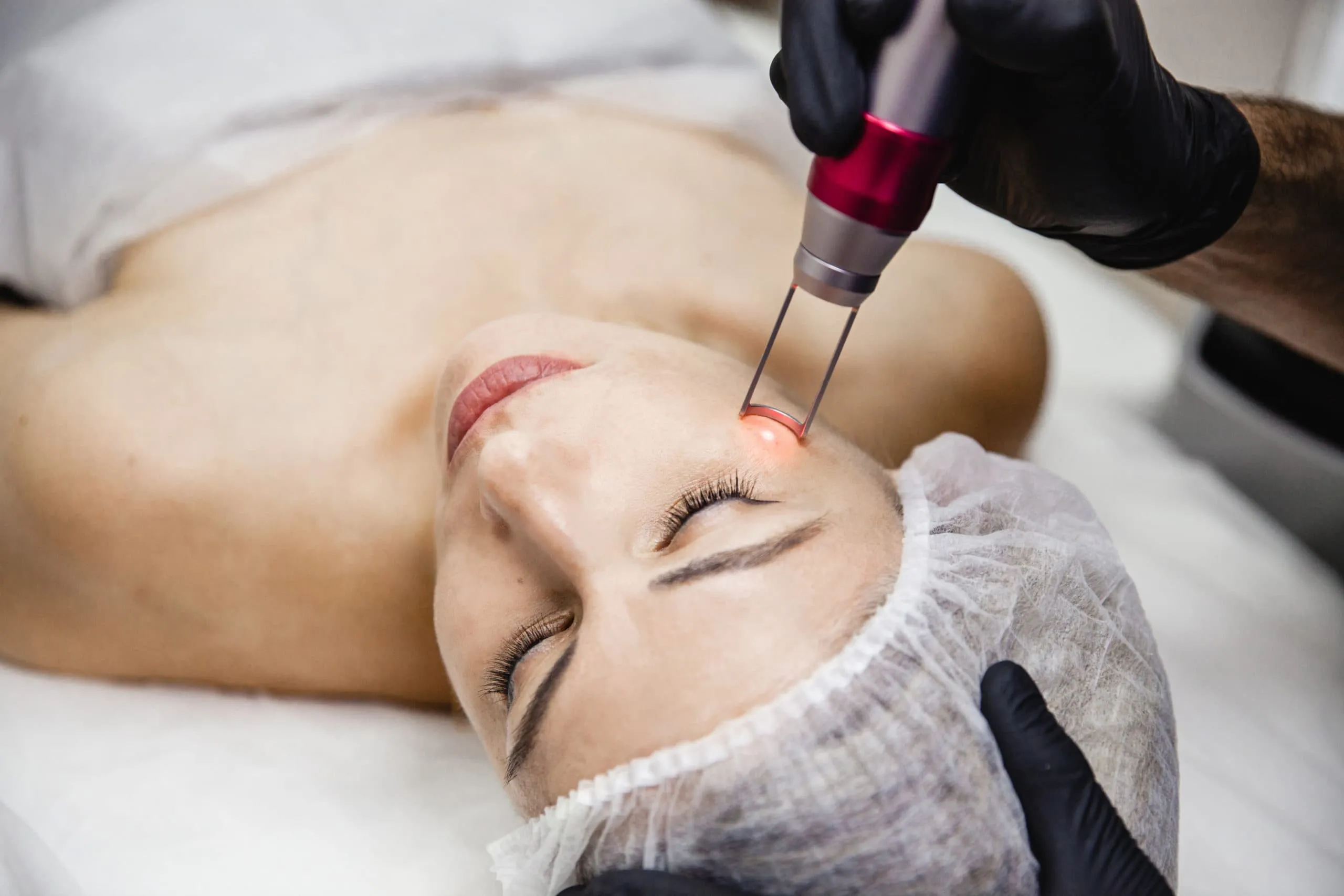 Female patient getting PICO laser treatment on face at Elysian Medspa & Rejuvenation Center