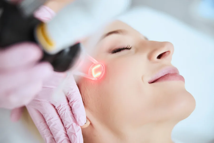 Woman receiving IPL treatment on her cheek