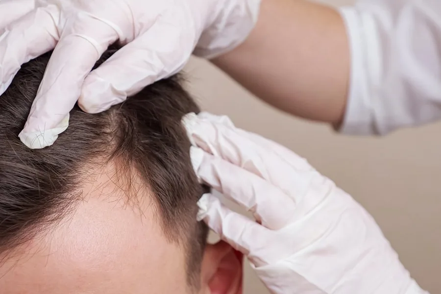 Provider examining a patient’s scalp for PRP hair restoration